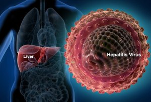 cara mengobati hepatitis A